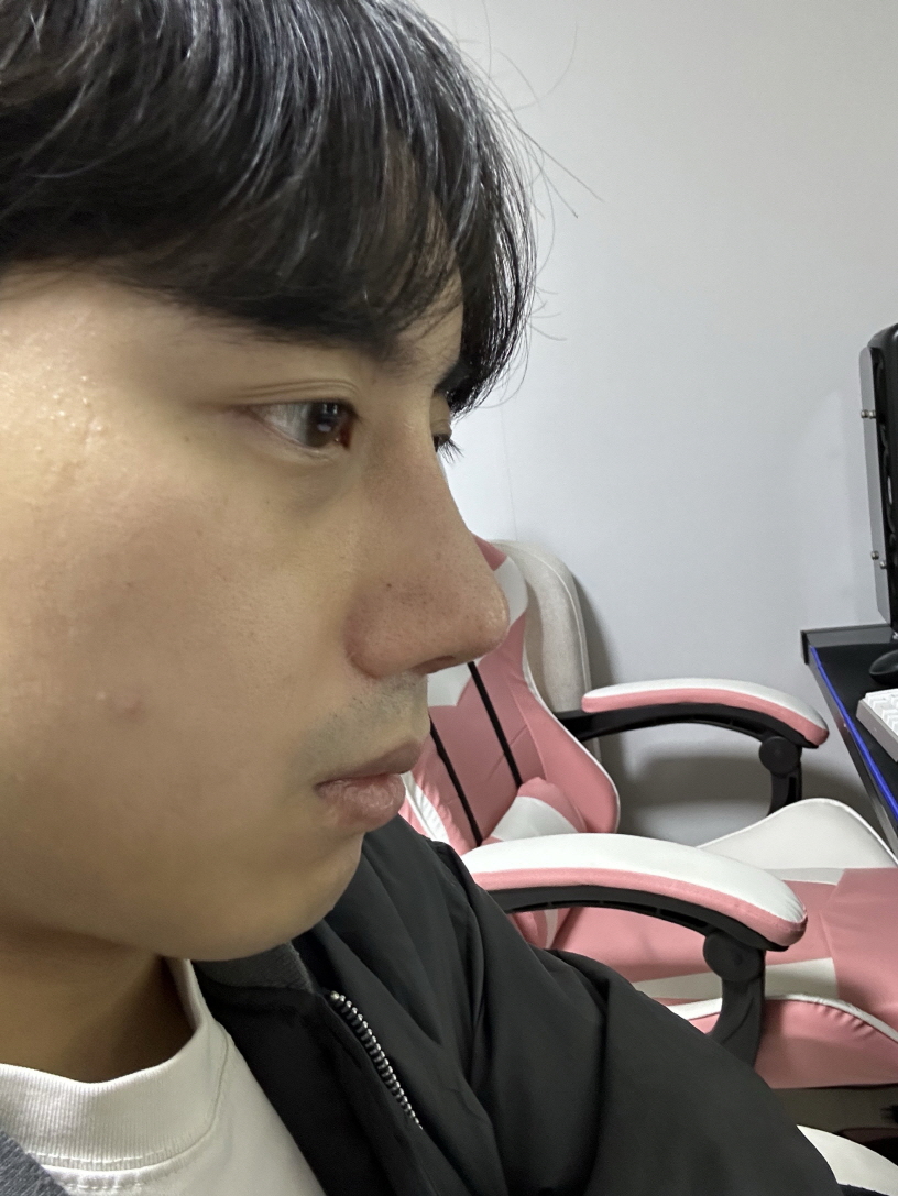 꼼꼼히 잘 살펴주시고 원하는 방향으로 최대한 잘 수술해주셨어요!