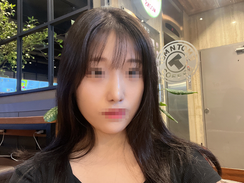 원래 콧대가 정말 1도 없었는데 이 정도면 사람 된 것 같아요 !하핳