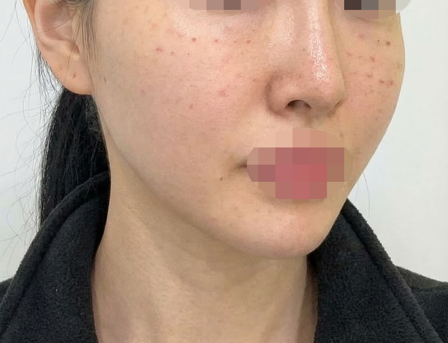 나비존 모공 때문에 받았는데, 받길 잘한 것 같네요~ㅎㅎ