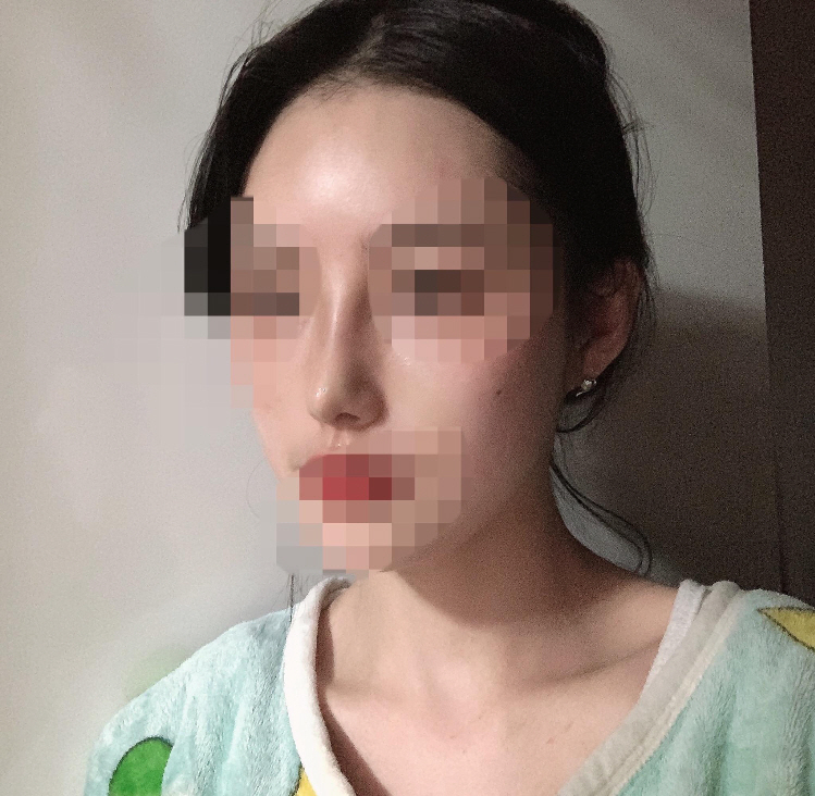 코 2주차 후기