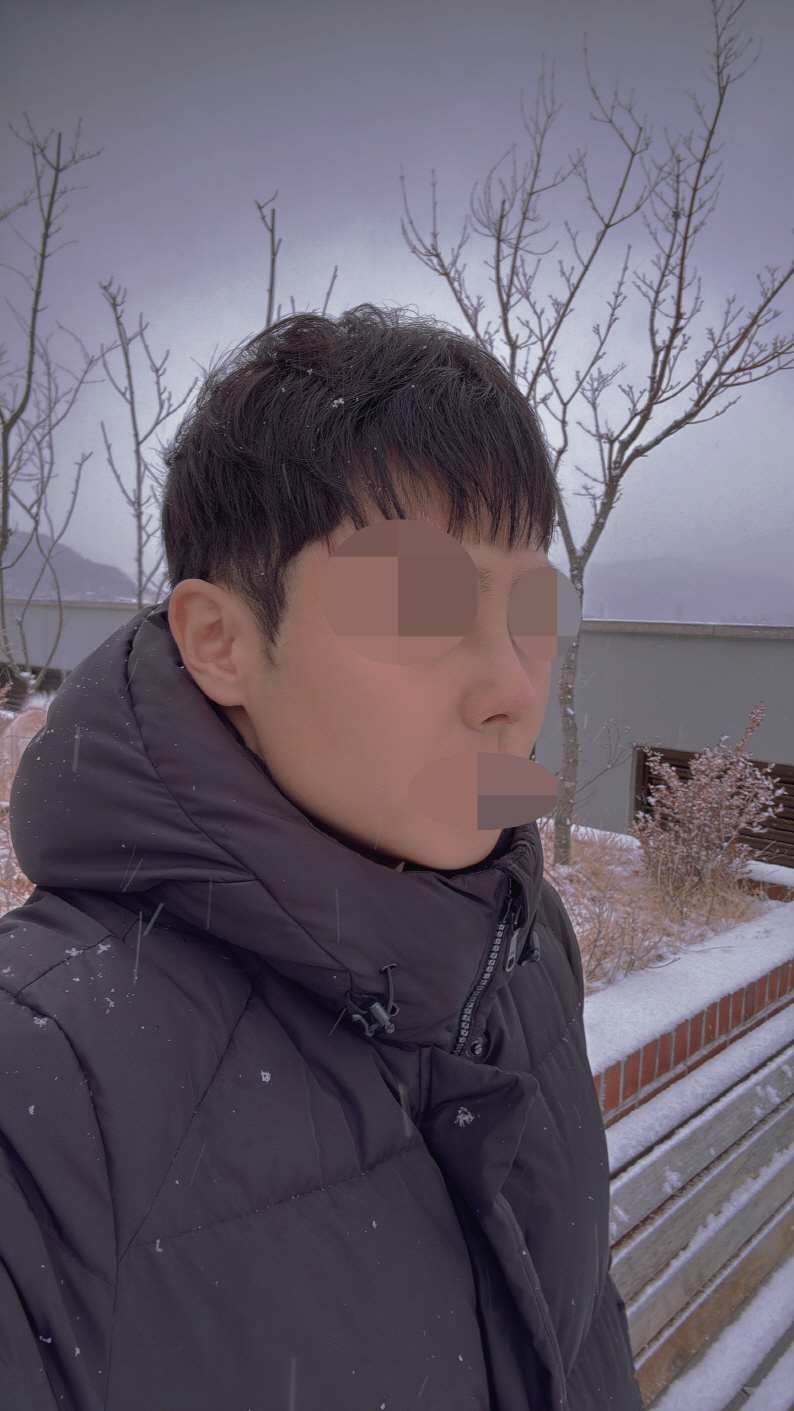 붓기가 빠지면서 또 다르게 변하는 모습이 정말 보기 좋습니다.