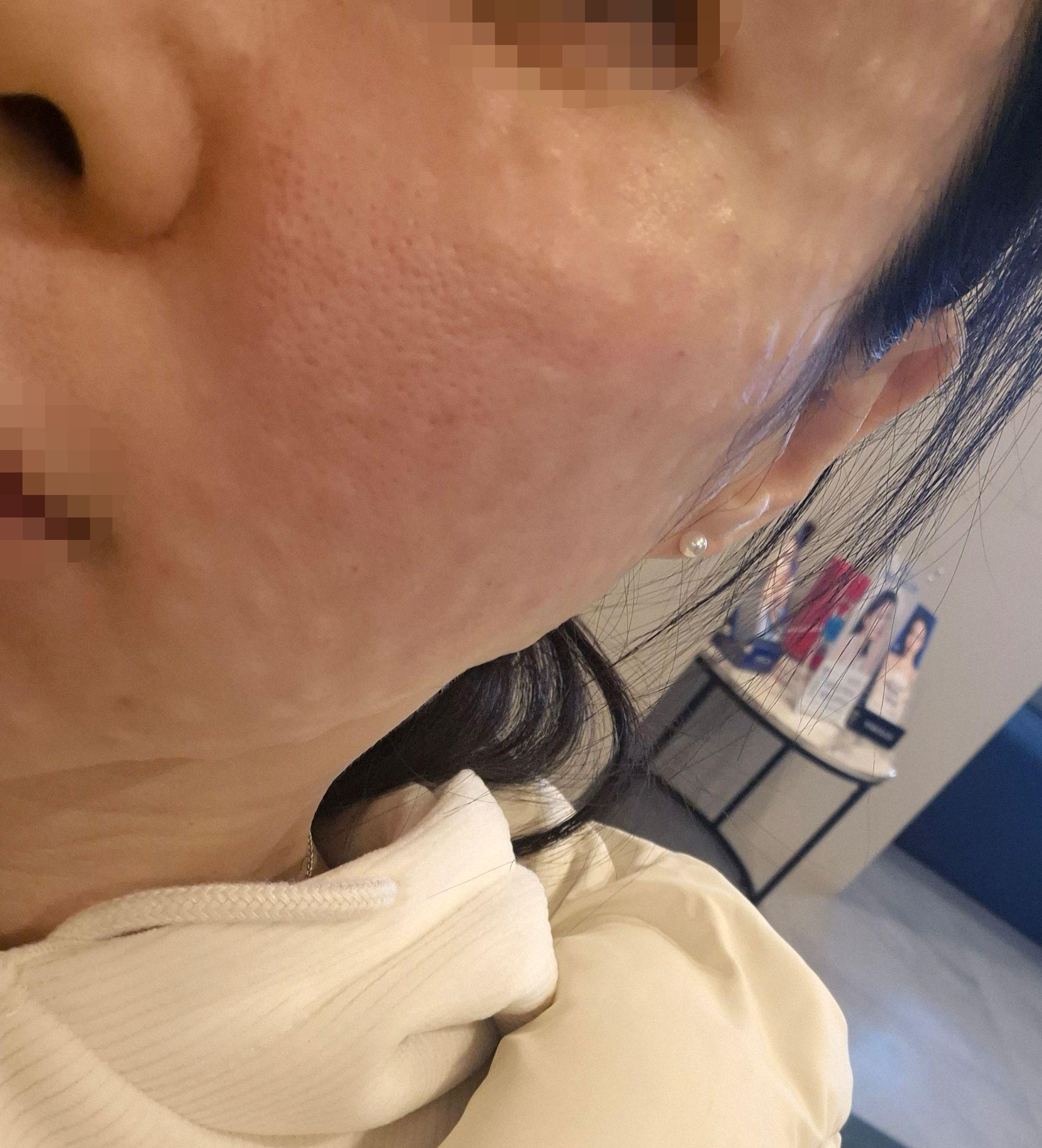 추가 권유 없고, 수면으로 받아서 편하게 받았습니다!