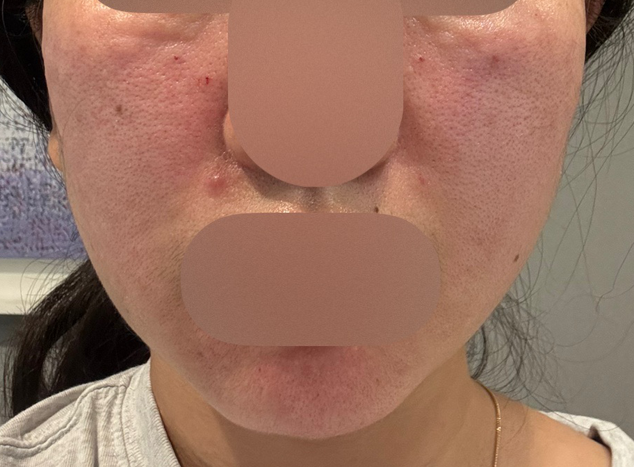 빠른 응대에 꼼꼼한 케어까지, 모공 관리는 여기서 받을라고요~ㅎㅎ