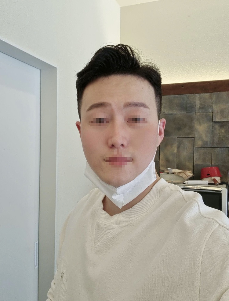 낮은코 극복