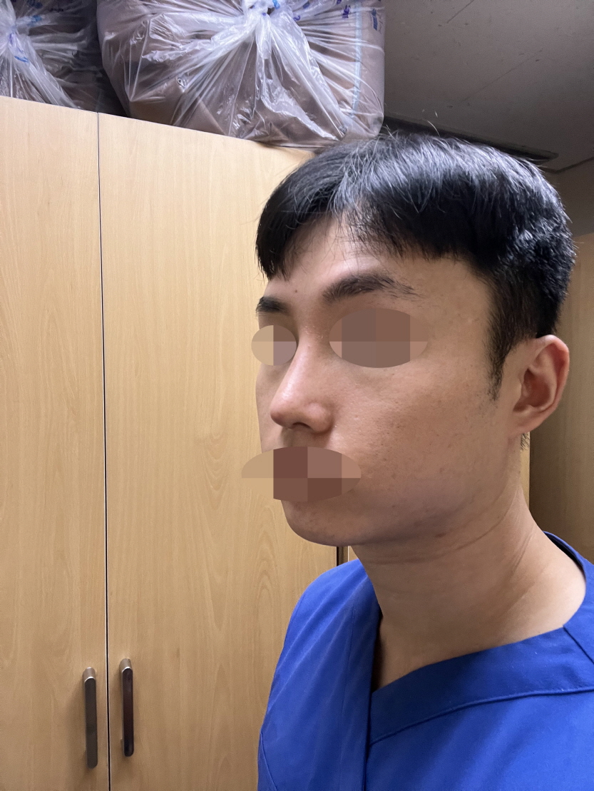 주변에서 잘된것같다고도 하고 진료할때 설명잘해주셔서 마음이 놓였어요.