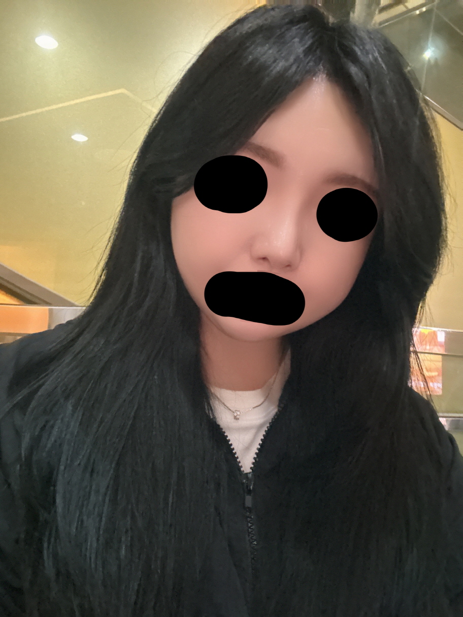 코수술하길 진짜 잘했다 생각하고 살고있어요