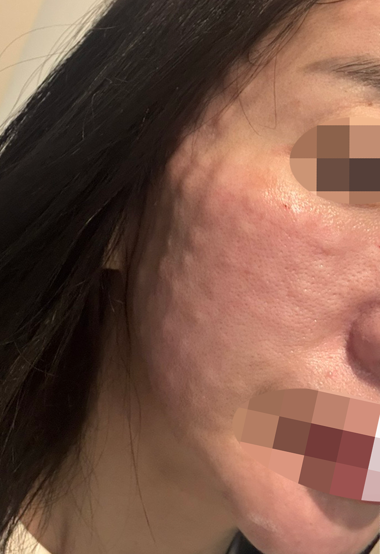 엠보 빵빵하게 잘 잡혀서 대만족이라 재방문 할려고요ㅎㅎ