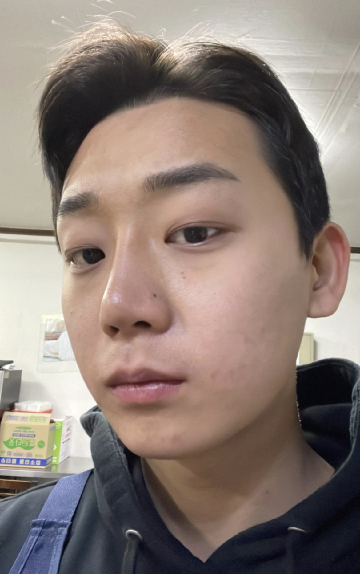 가족 추천으로 가서 황정일 원장님께 수술 받았는데 만족스럽습니다~~^^