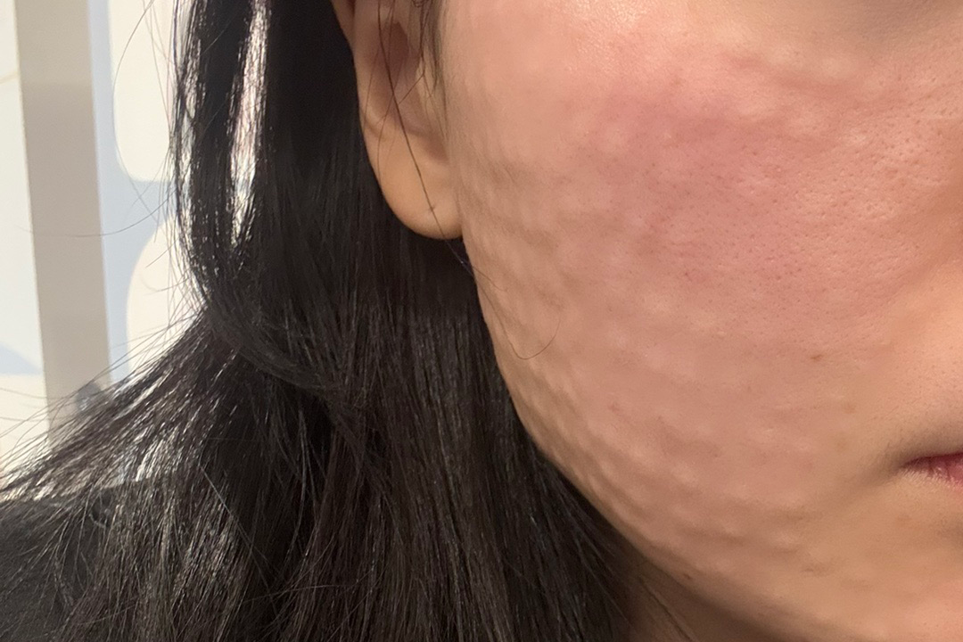 후기 보고 왔는데 원장님 먼저 상담해주셔서 좋았어요 ㅎㅎ