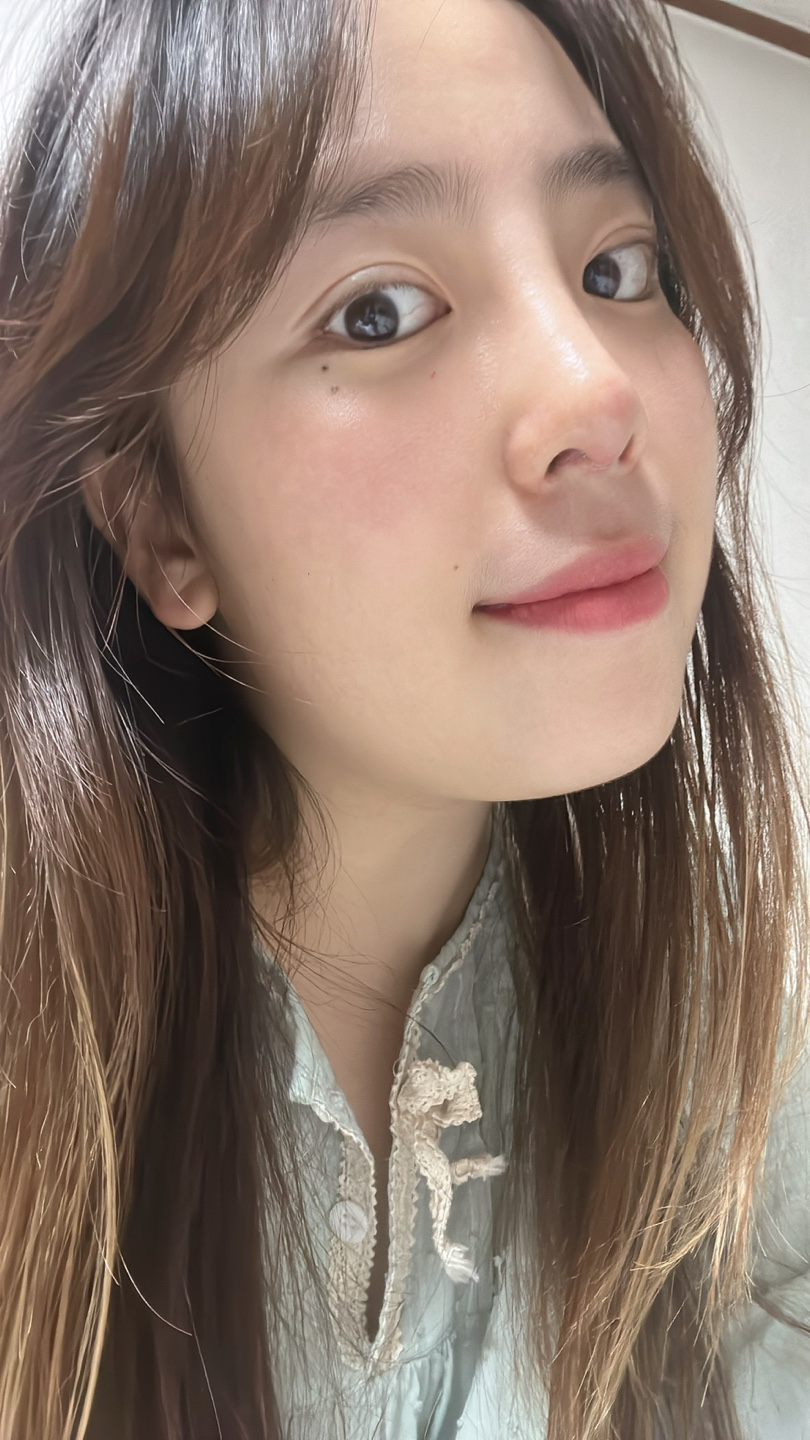 코 수술한지 2주차 되었어요