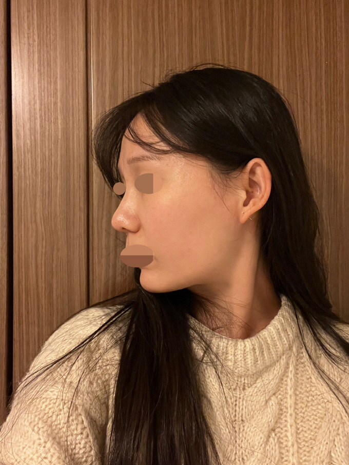 자연스러운 코 원하면 꼭 여기!