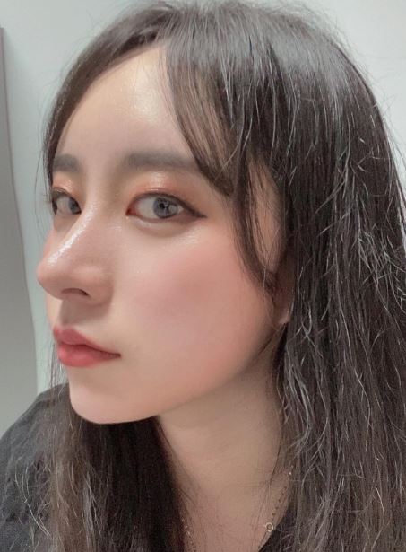 코수술 두달차 후기입니당당