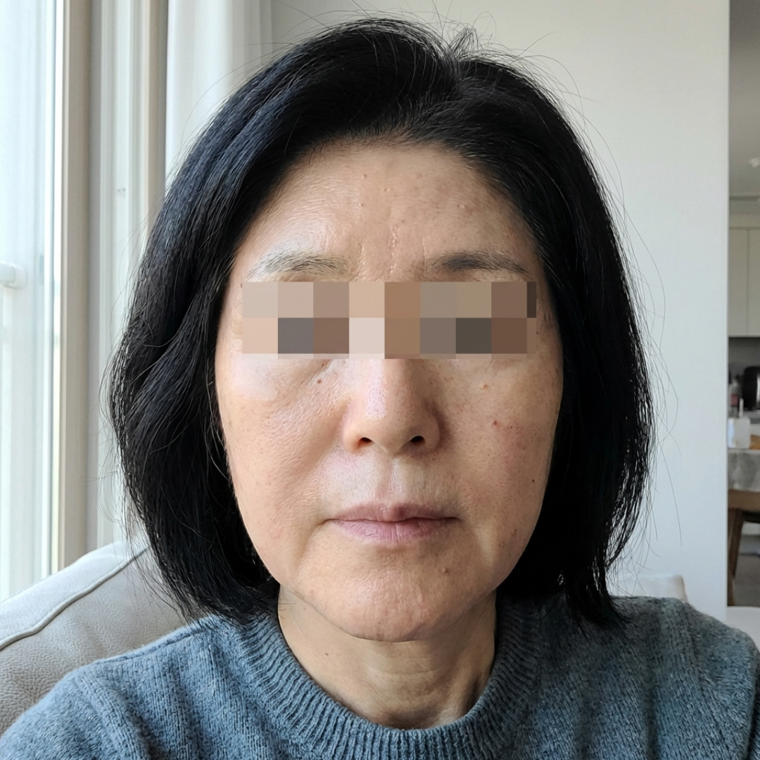 아들 결혼식 전에 받길 정말 잘했어요