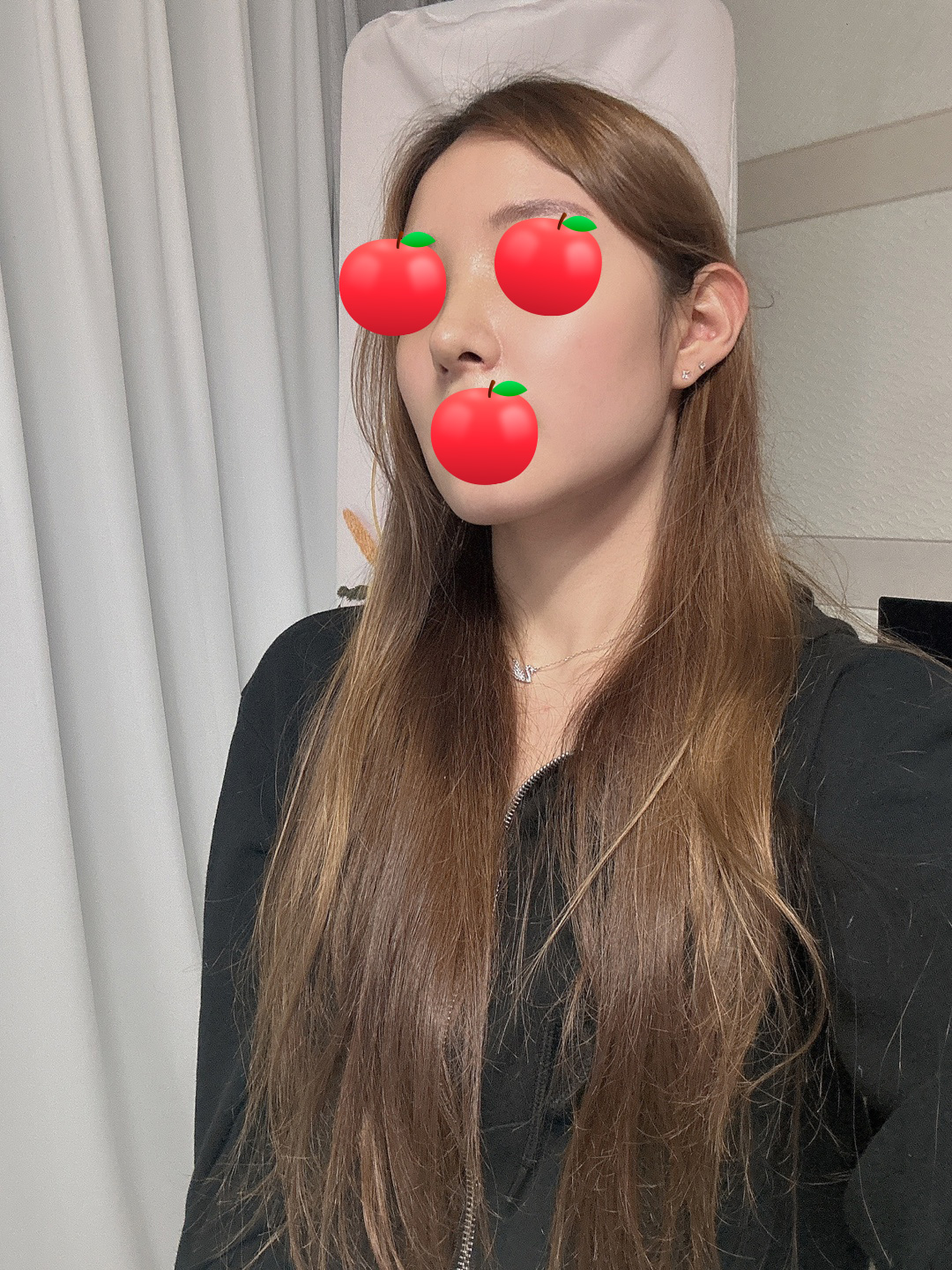 인위적인것 보다는 자연스러운 스타일을 추구해서 서울아이 성형외과로 선택했어요