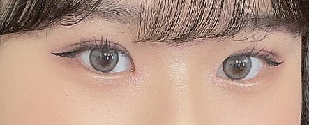 쌍꺼풀 만족스럽게 된거같구요 매우 만족입니다~^_^