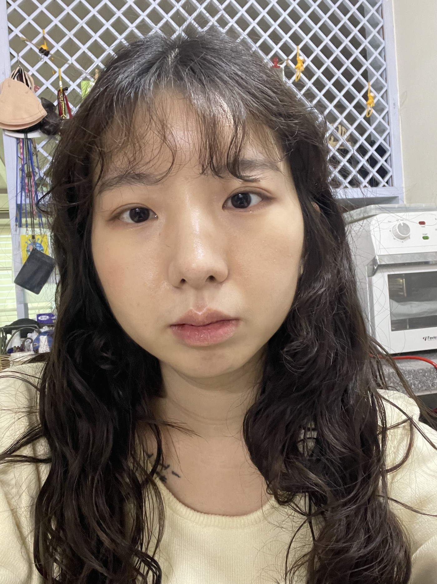 다른 친구들도 넘 예쁘게 잘 되었다고 병원 물어봐서 알려주고 다니고 있습니다!