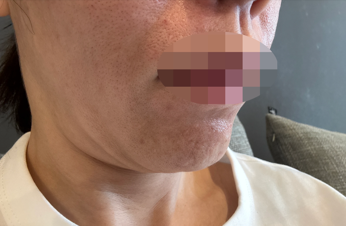 한국 방문 김에 받아봤는데 통역 덕분에 불편함 없이 끝났어요!