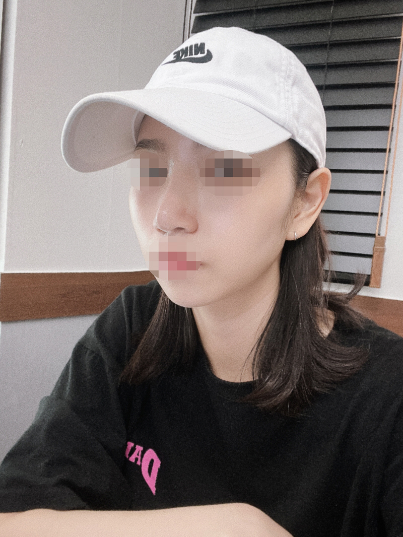 서울아이에서 재수술 결정하고 2번째 수술이라 걱정했는데 괜한 걱정이였어요 !!