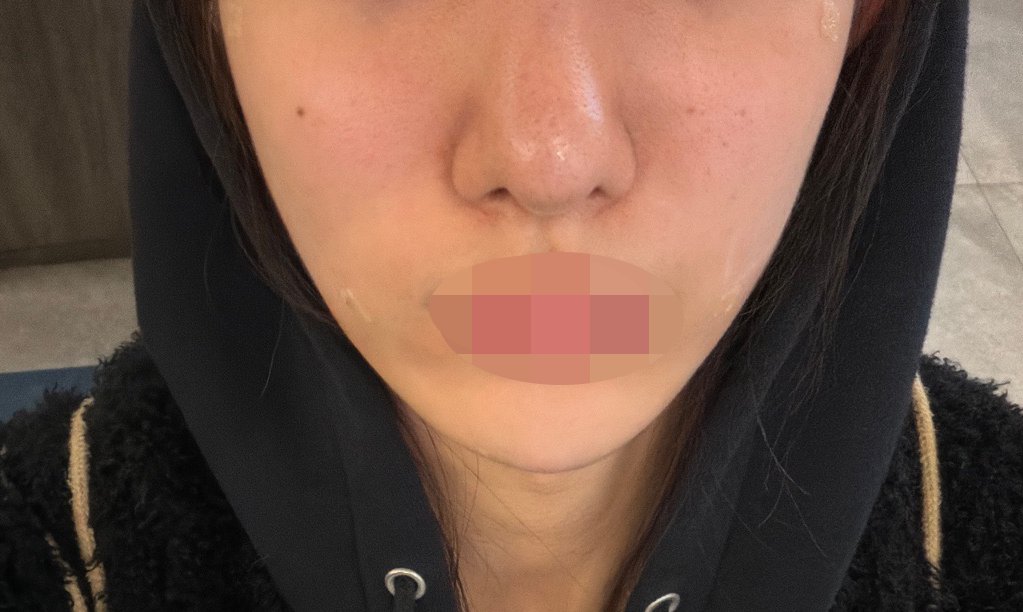 스컬트라 받았는데 다들 친절하고 완전 만족이에요 ㅎㅎ
