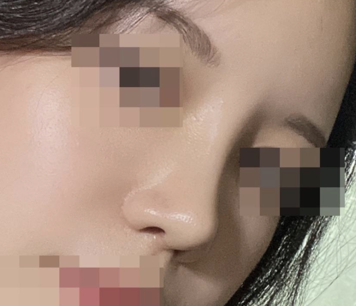 코 모양이 많이 교정된 것 같아서 마음에듭니다!