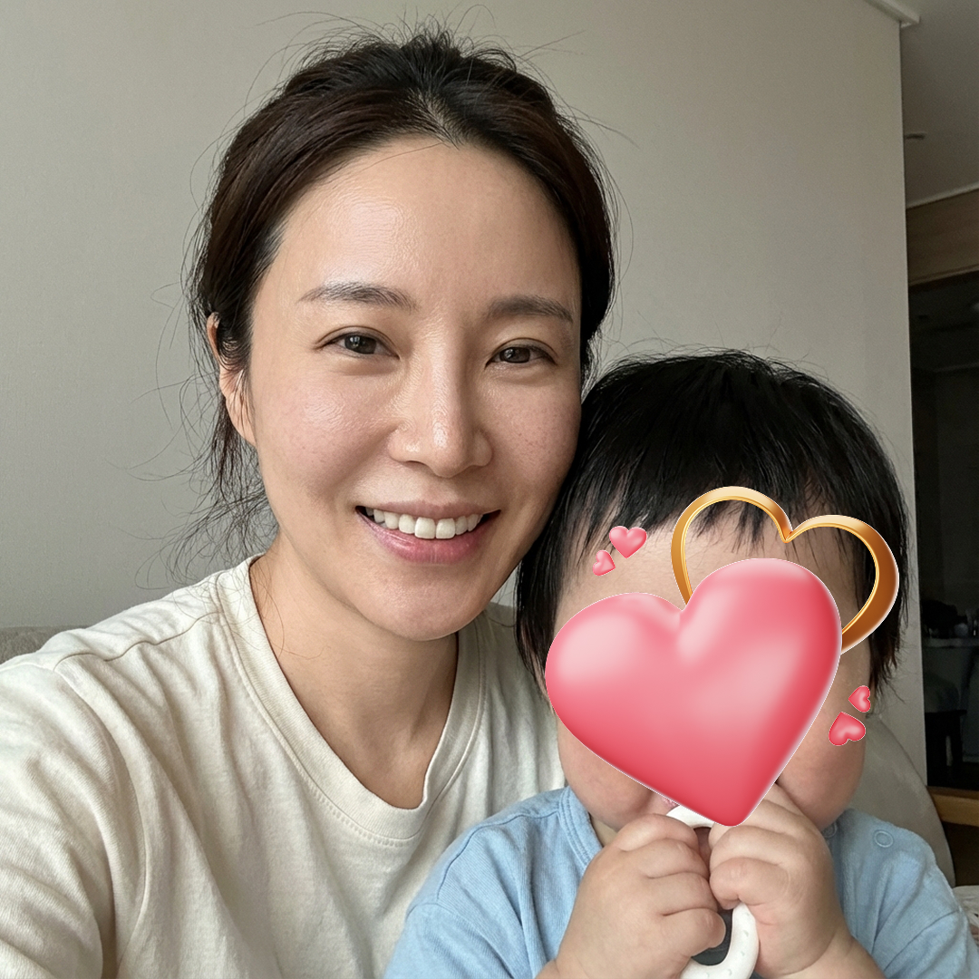 팔자 때문에 10년은 늙어 보였는데 인상 자체가 달라졌어요