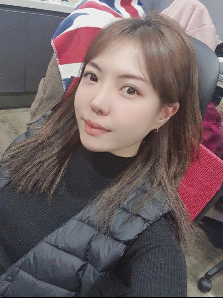 코 재수술 3달째예여