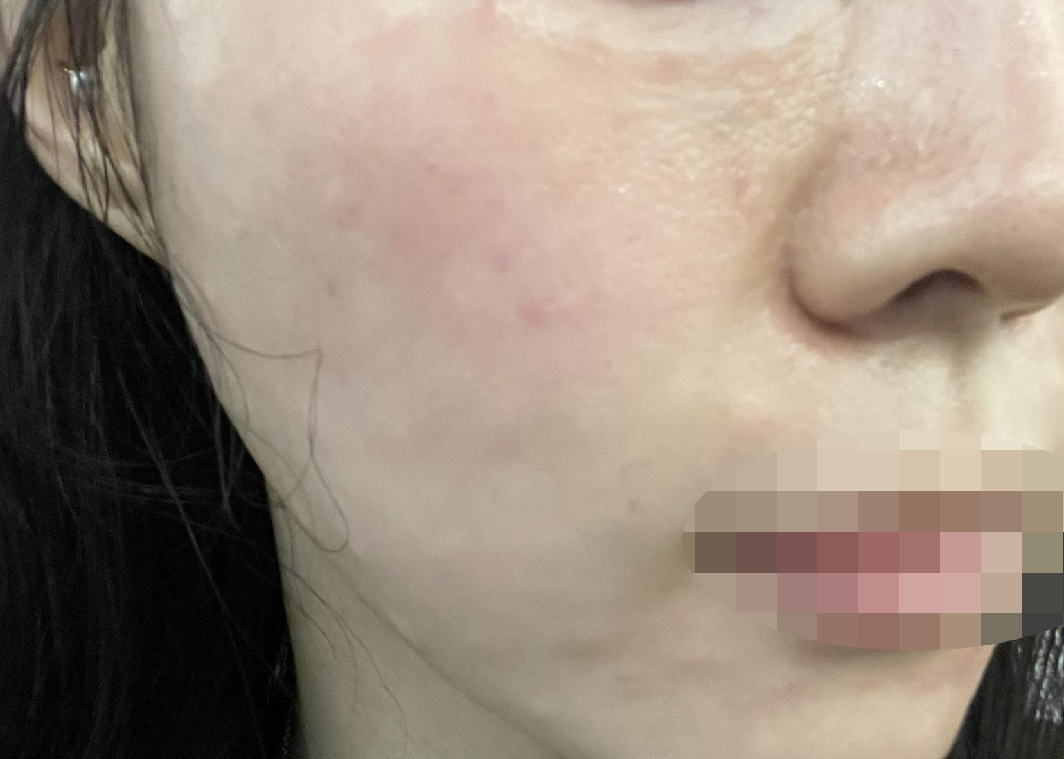 눈 앞에서 정품 인증해 주시고 수면으로 편하게 받고 왔어요~!!