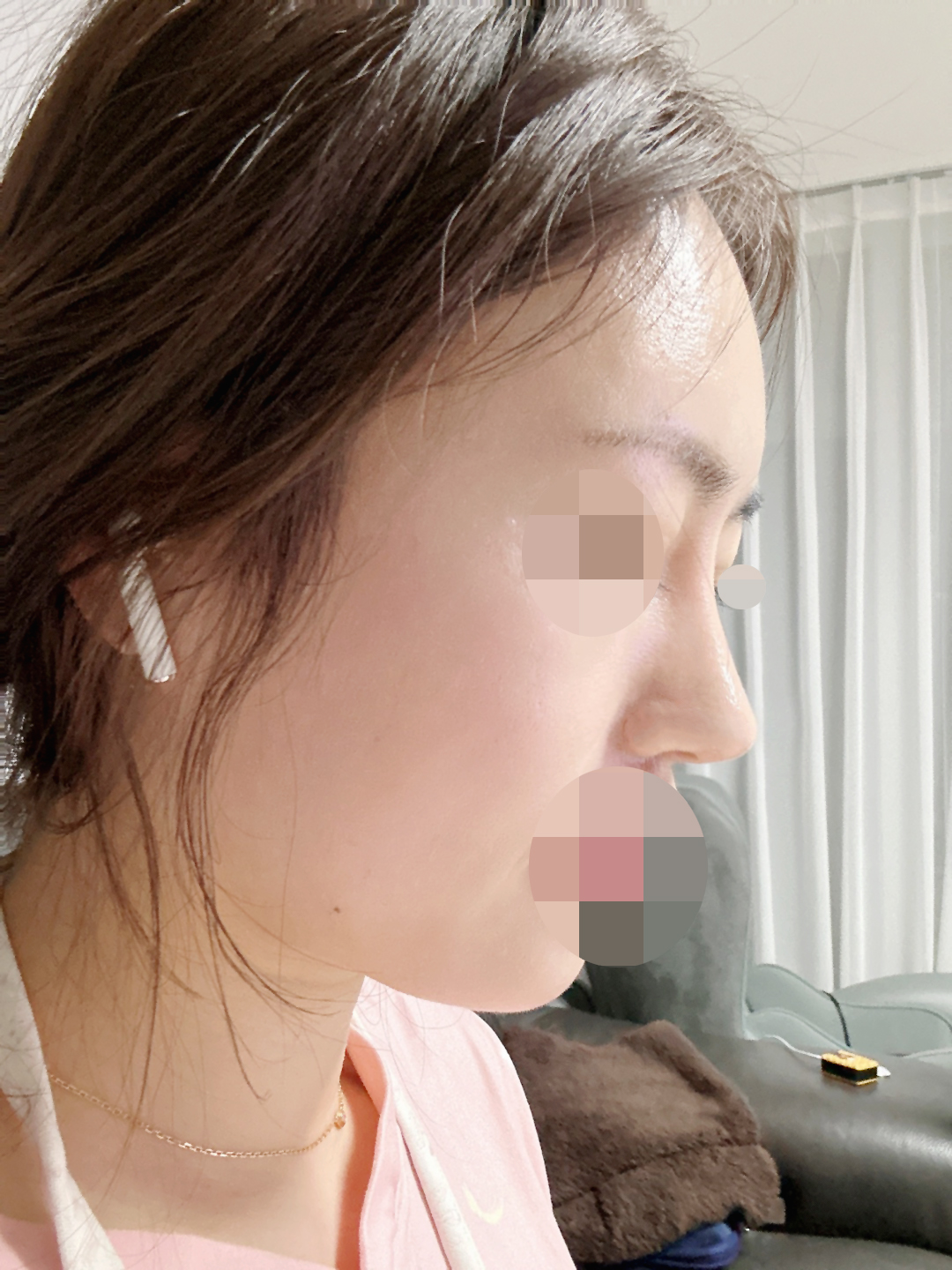 큰맘먹고 한 재수술 만족합니다!