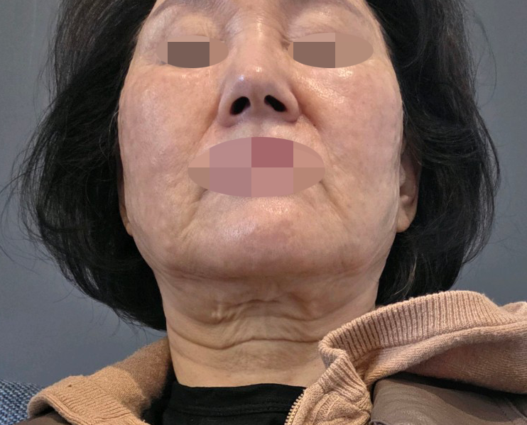 리쥬란 늘 믿고 다니는데 꼼꼼하셔서 항상 방문합니다~
