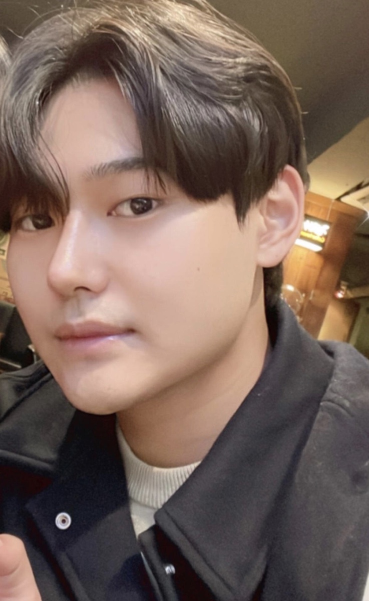 코성형 했습니다ㅎㅎ
