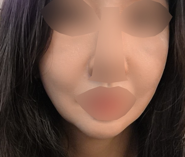 2회차인데 꼼꼼해서 한 달 후 3회차도 받으러 올 거예요 ㅎㅎ