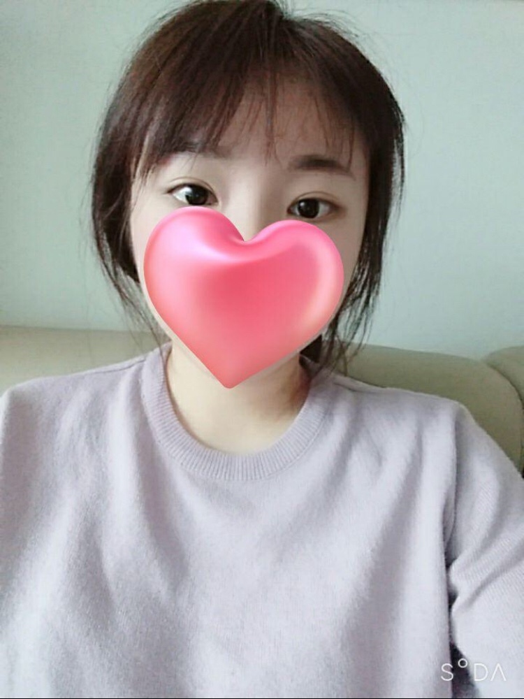 눈수술후기~!