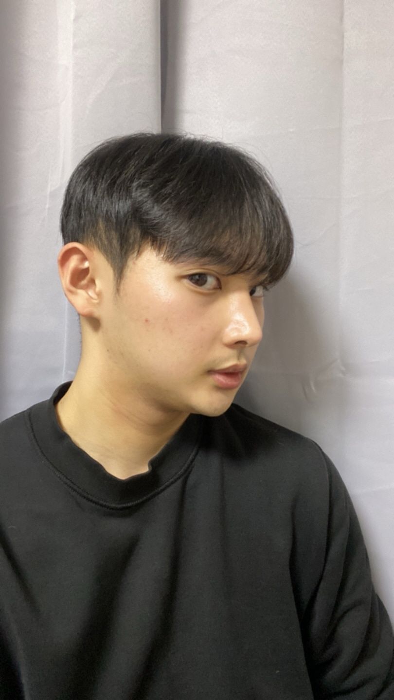 너무 친절하시고 자세하게 설명해주셔서 믿고 수술했는데 너무 만족스럽네요