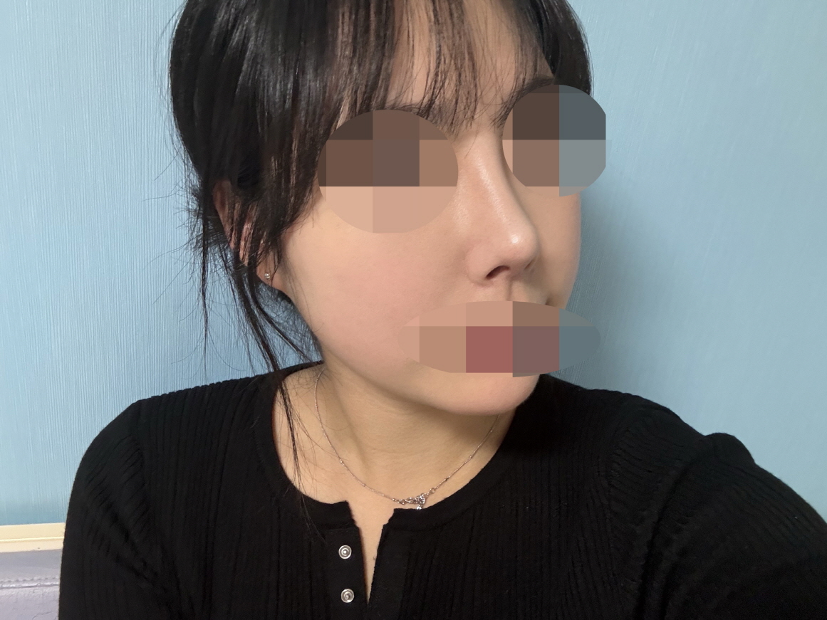 후기들이 넘 자연스럽구 이뻐서 그렇게 하고 싶었는데 원하던대로 됐습니다!!ㅎㅎ