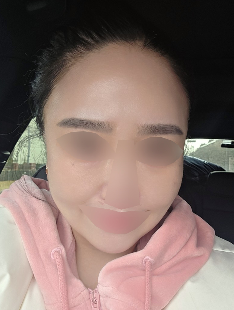 수면으로 편하게 받은 쥬베룩, 효과 보고 3회 채울 예정이에요~