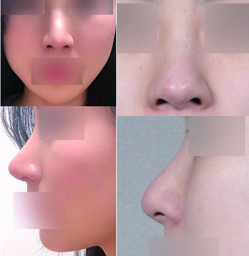 코수술은 서울아이!
