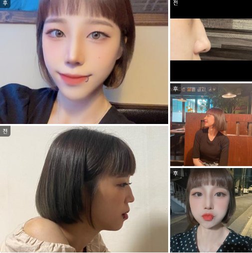 매부리 컴플렉스 안녕~