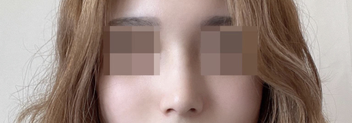 첫코 한달차 다 되었어용