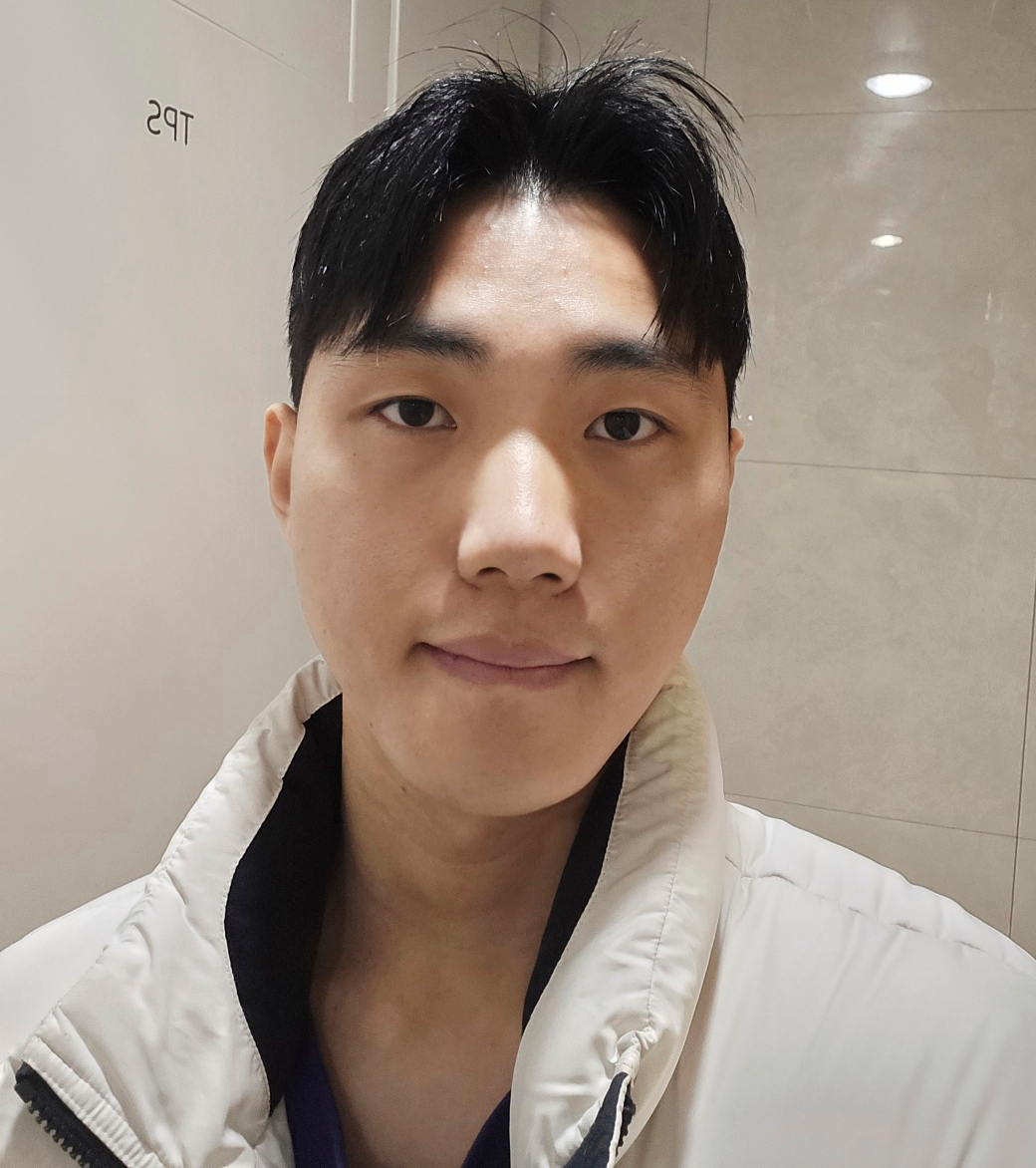 남자코성형! 4개월 지나니 원하는 코 라인이 보입니다.