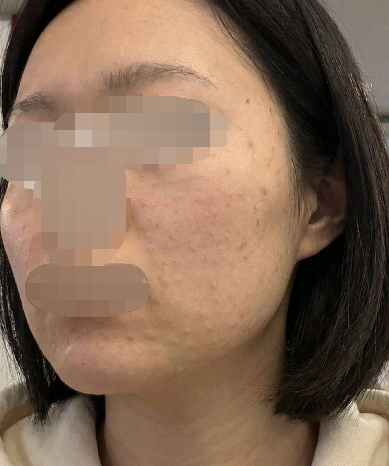엠보 잘 남고 시설도 좋아서 여러모로 대만족이에요!!