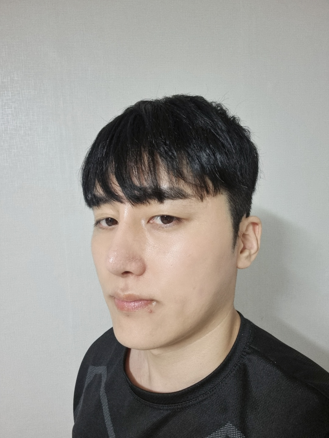 수술 3개월 차입니다. 점점 모양 이뻐지네요
