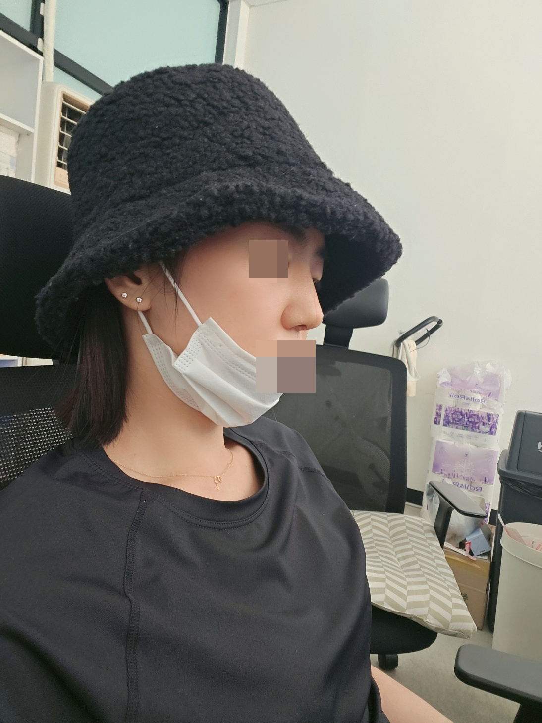 수술후 생각했던 코모양보다 더 예쁘게 됐어요