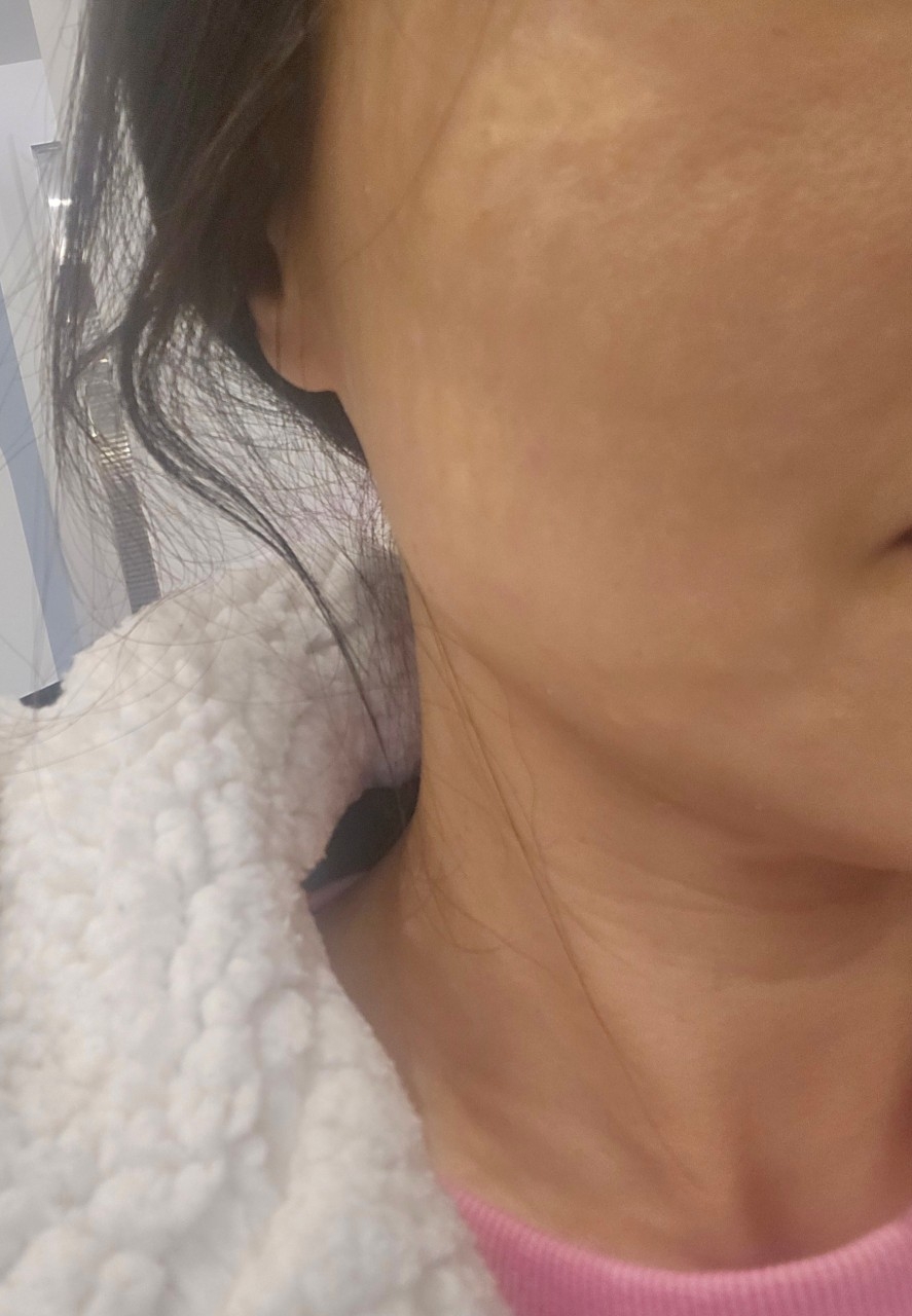 첫 방문 긴장 싹 녹았어요~ 서울아이 친절함 소문 그대로네요!