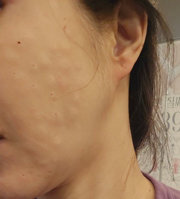 리쥬란 수면으로 받았는데 정품 확인해주시고 엠보 촘촘해서 만족이에요 ㅎㅎ