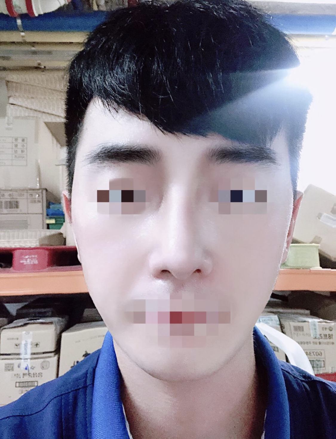 코수술하고 훈남됫네옄ㅋㅋ