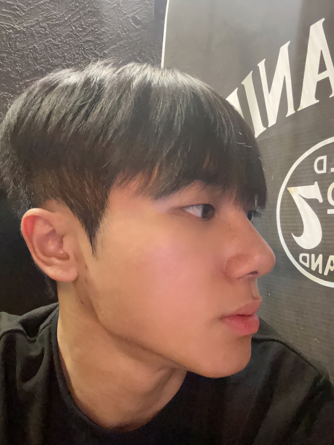 다들 보자마자 코가 예쁘다고 칭찬해주셔서 자신감도 많이 올라갔어요