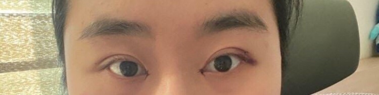 쌍수했습니댱ㅋ