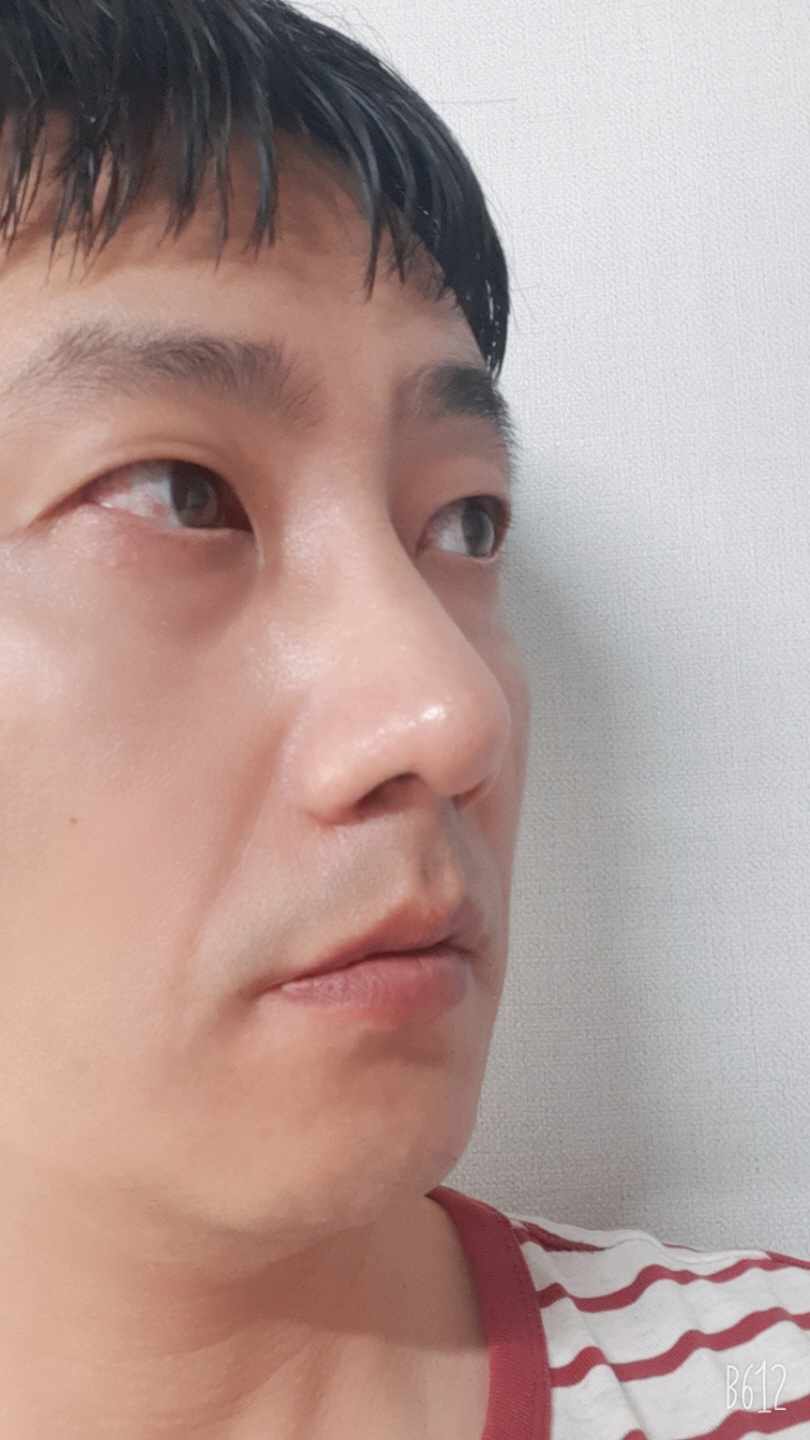 친절하시고 코수술 추천드려요