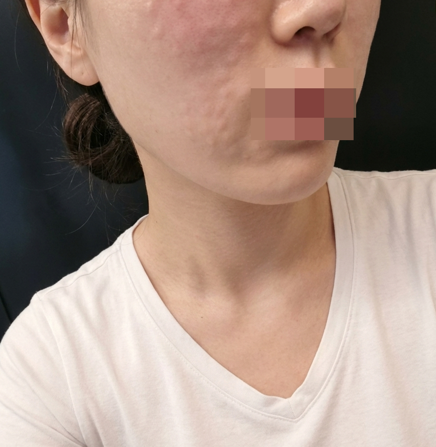 친절한 응대에 만족스러운 시술까지! 다음 달에도 또 갈게요ㅎㅎ