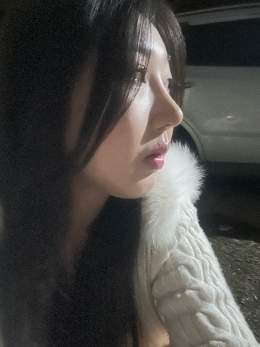 자연스러운 높은 코 예쁘게 잘 됐구 윤곽으로 얼굴선도 이쁘게 정리됐어용